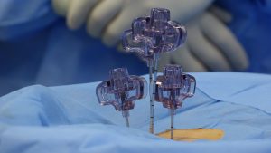 Patient Resources Close view of surgical tools during a spinal procedure in an OR.