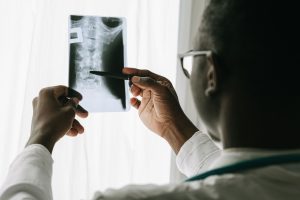 Patient Resources Close-up of a doctor examining a spine X-ray film with a pen in a hospital setting.