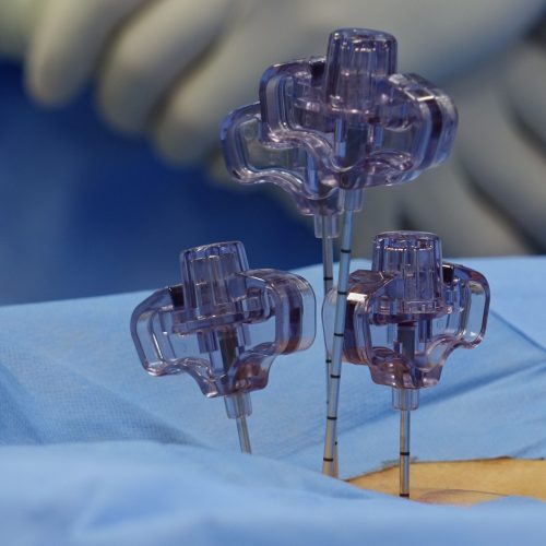 Close view of surgical tools during a spinal procedure in an OR.