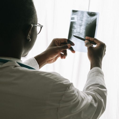 Doctor analyzing an x-ray with a pen, highlighting patient diagnosis.